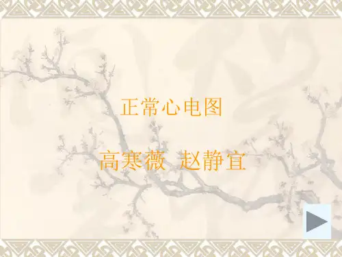 正常心电图
