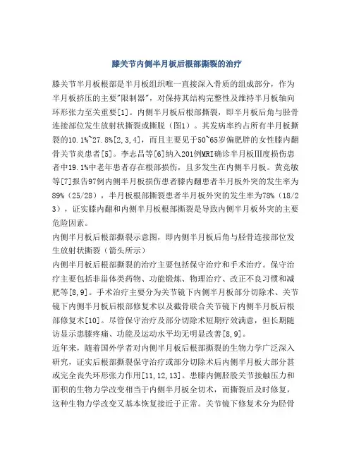 膝关节内侧半月板后根部撕裂的治疗