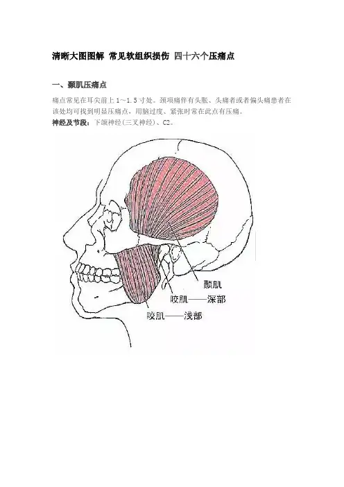 清晰大图图解 常见软组织损伤 四十六个压痛点