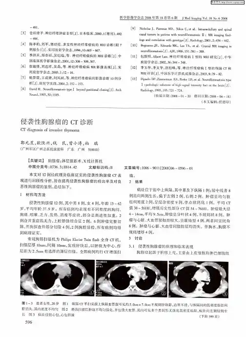 侵袭性胸腺瘤的CT诊断