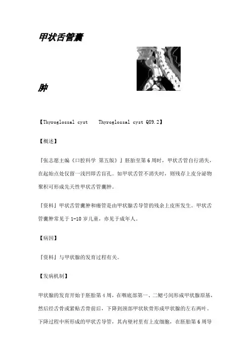 甲状舌骨囊肿