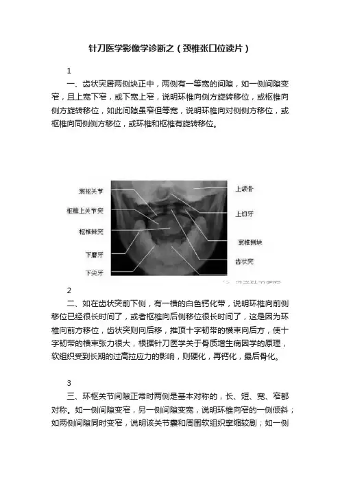 针刀医学影像学诊断之（颈椎张口位读片）