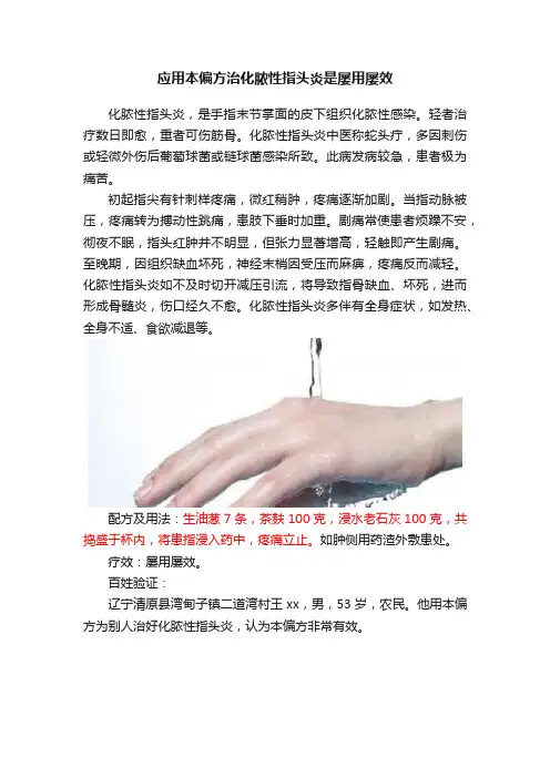 应用本偏方治化脓性指头炎是屡用屡效