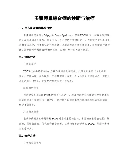 多囊卵巢综合症的诊断与治疗