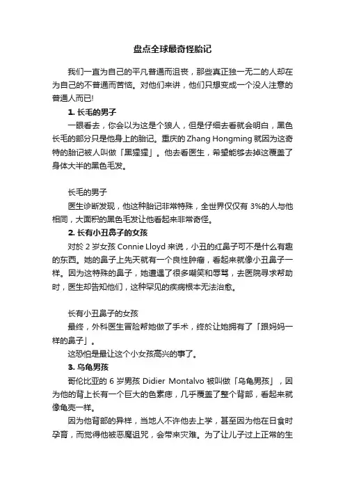 盘点全球最奇怪胎记