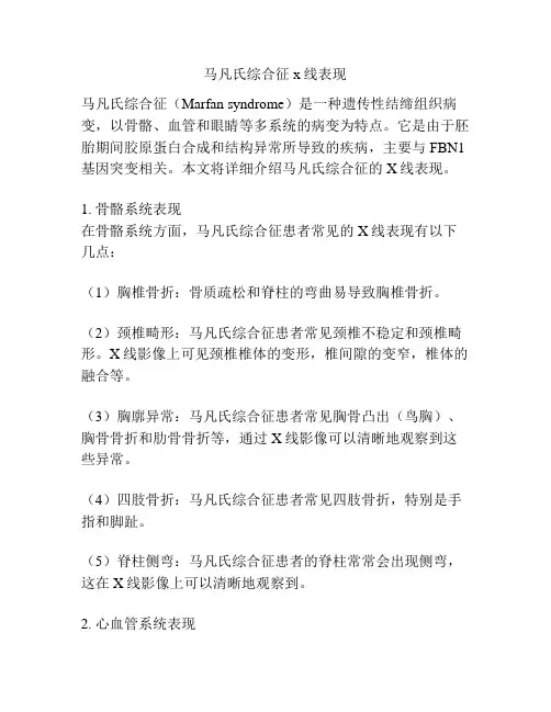 马凡氏综合征x线表现