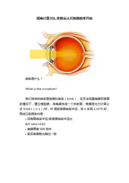 精确计算IOL度数从认识角膜曲率开始