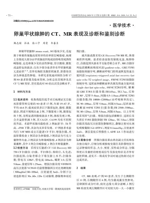 卵巢甲状腺肿的ct、mr表现及诊断和鉴别诊断