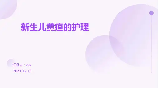 新生儿黄疸的护理PPT课件