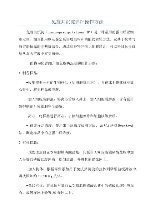 免疫共沉淀详细操作方法