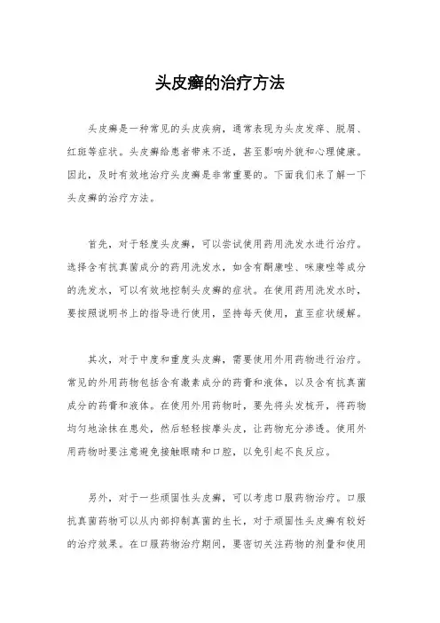 头皮癣的治疗方法