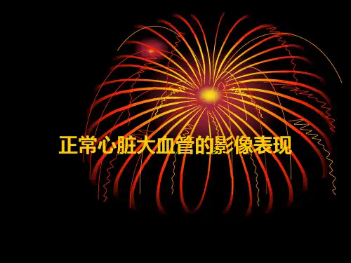 心脏大血管的影像表现.ppt