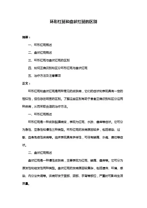 环形红斑和盘状红斑的区别