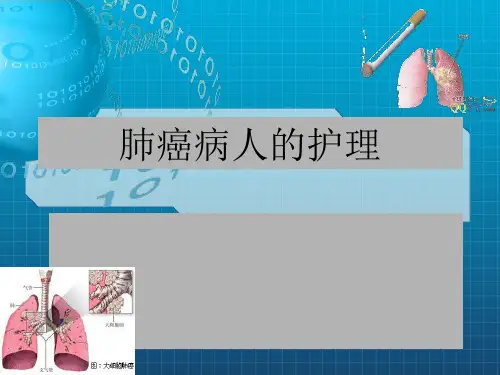 肺癌患者护理查房PPTppt课件
