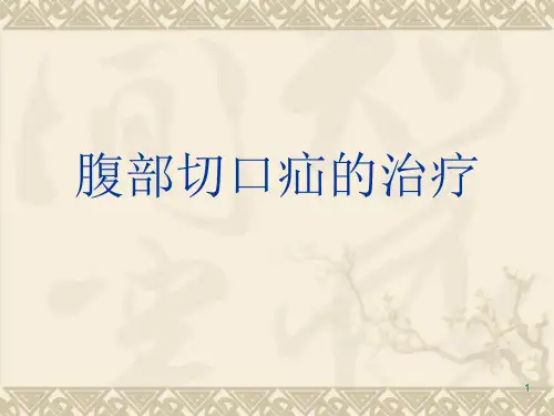 腹壁疝的治疗PPT参考幻灯片