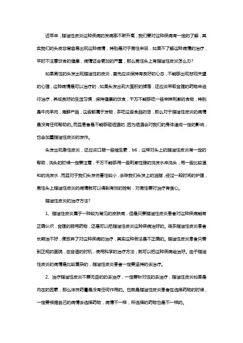 男性头部脂溢性皮炎