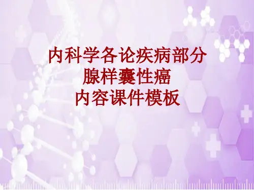 内科学_各论_疾病：腺样囊性癌_课件模板