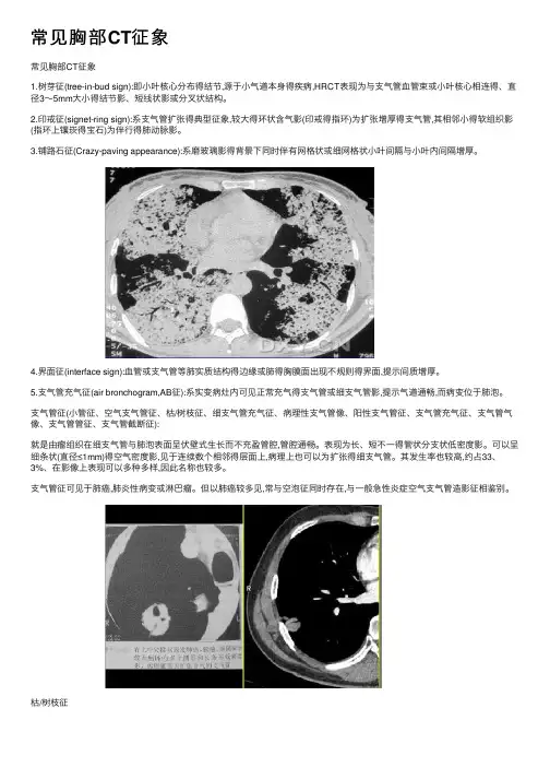 常见胸部CT征象