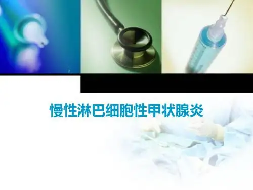 慢性淋巴细胞性甲状腺炎