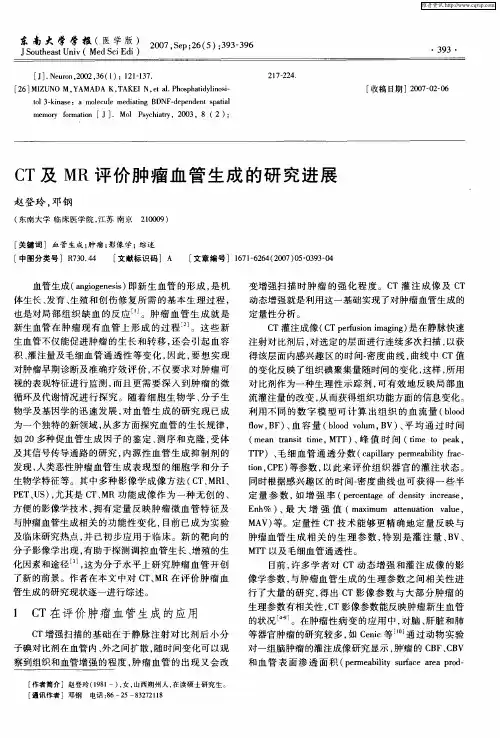 CT及MR评价肿瘤血管生成的研究进展