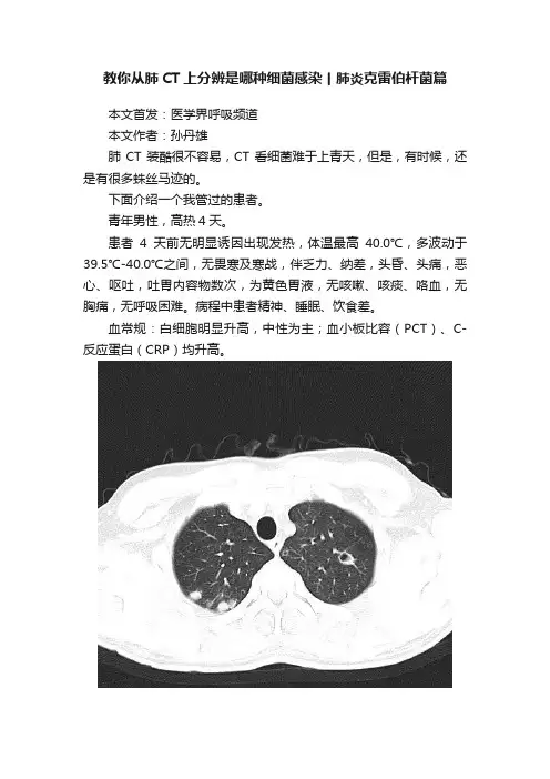 教你从肺CT上分辨是哪种细菌感染丨肺炎克雷伯杆菌篇