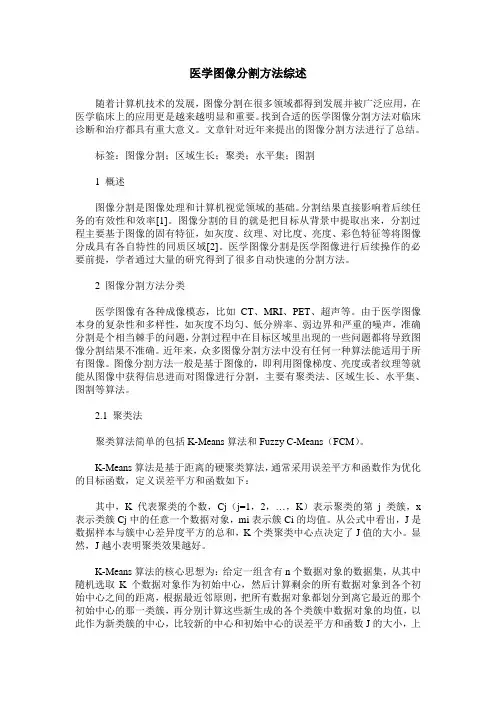 医学图像分割方法综述