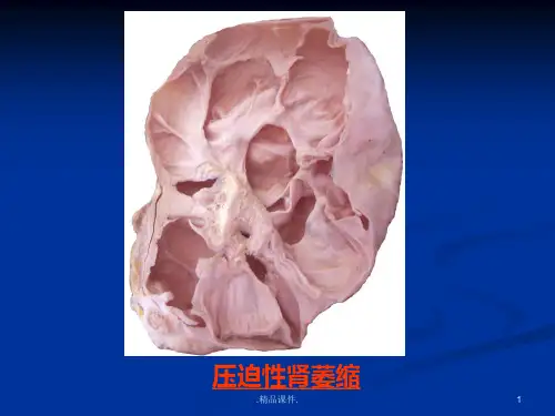病理切片考试图复习课件.ppt