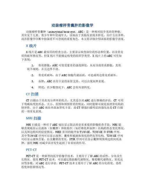 动脉瘤样骨囊肿的影像学