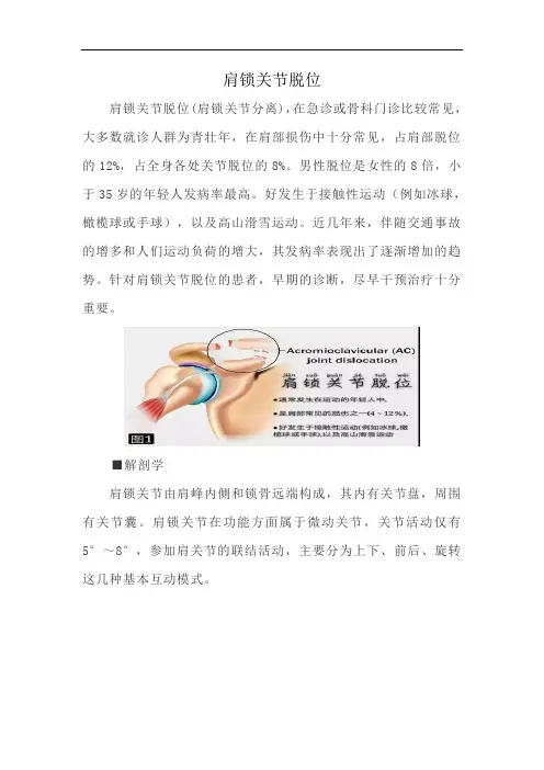 肩锁关节脱位