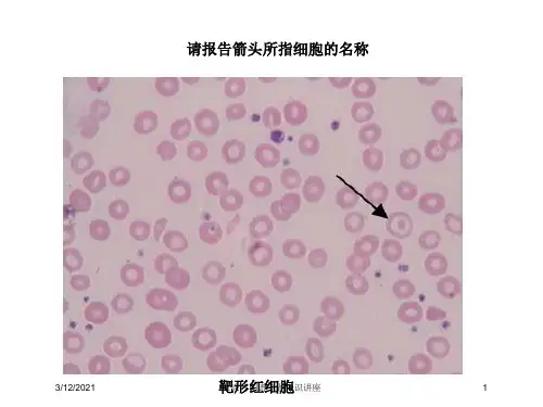 血涂片图谱专题知识讲座培训课件