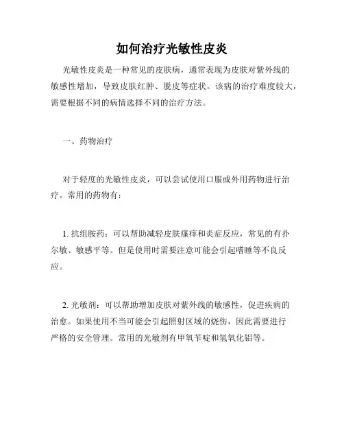 如何治疗光敏性皮炎