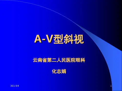 A―V型斜视
