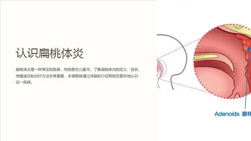 《认识扁桃体炎》课件