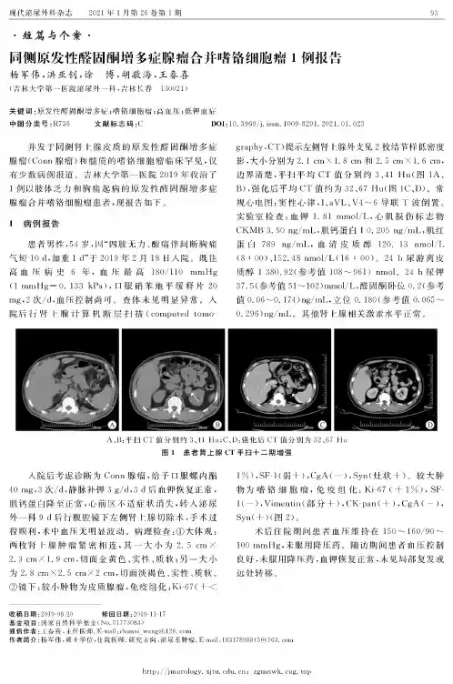 同侧原发性醛固酮增多症腺瘤合并嗜铬细胞瘤1例报告