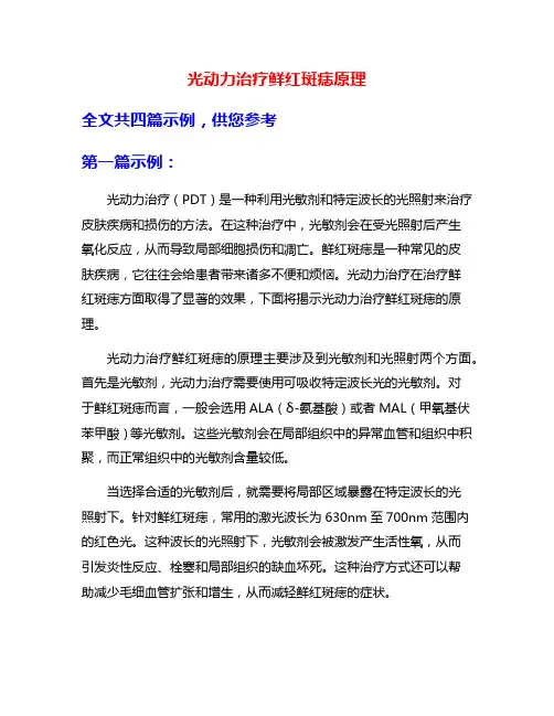 光动力治疗鲜红斑痣原理