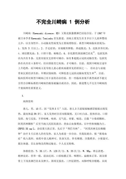 不完全川崎病1例分析