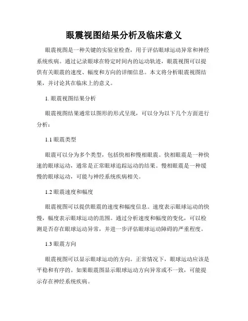 眼震视图结果分析及临床意义