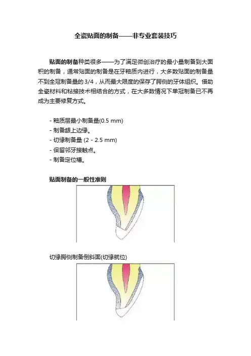 全瓷贴面的制备——非专业套装技巧
