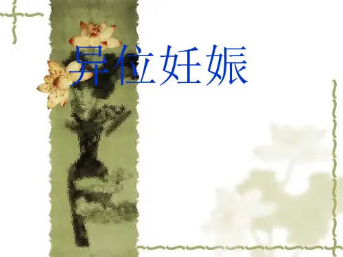 异位妊娠