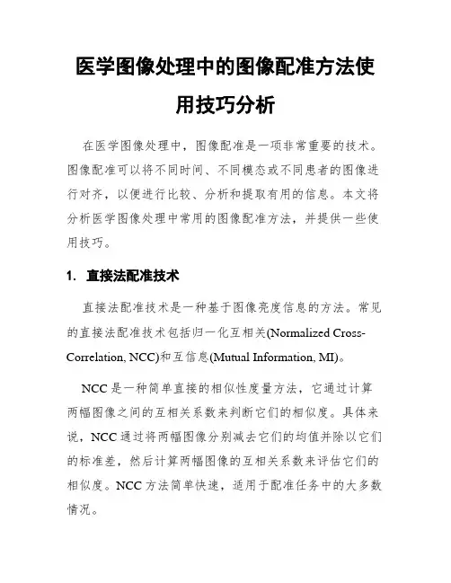 医学图像处理中的图像配准方法使用技巧分析