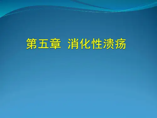 消化性溃疡-精品医学课件