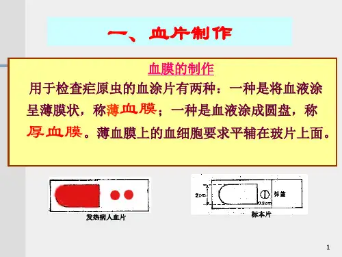 血片制作染色和血检质量控制培训(PPT 41页)