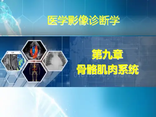 医学影像诊断学  内分泌与代谢性骨病ppt课件