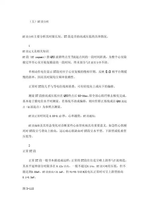 第十讲ST段分析