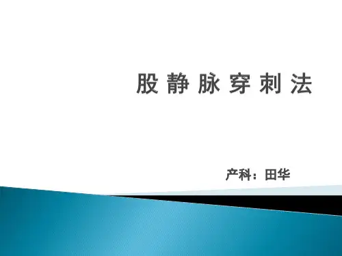 股静脉穿刺法详解