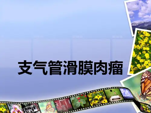 气管滑膜肉瘤PPT课件