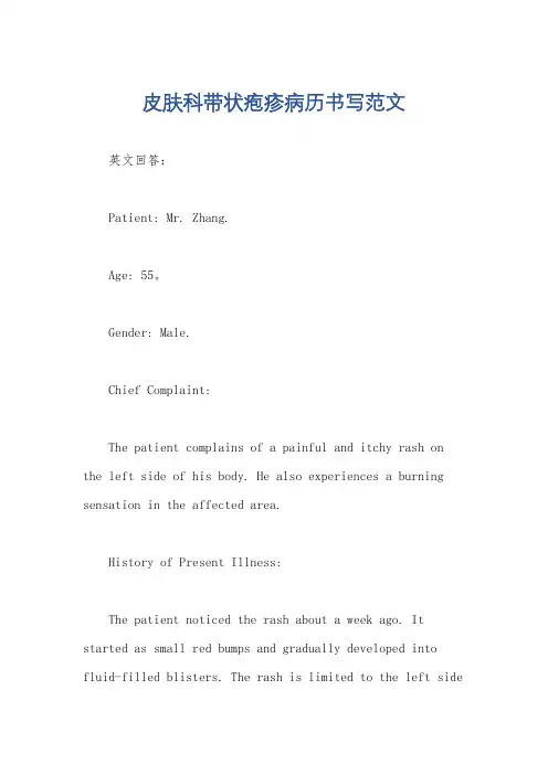 皮肤科带状疱疹病历书写范文