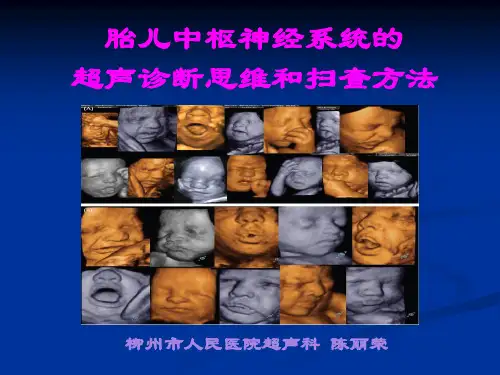 胎儿中枢神经系统