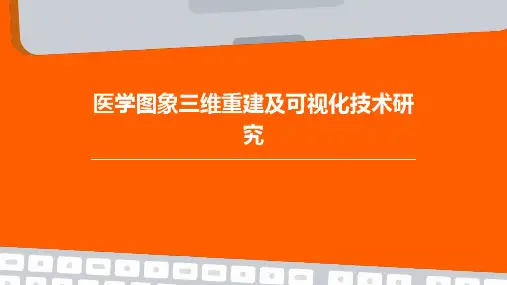 医学图象三维重建及可视化技术研究