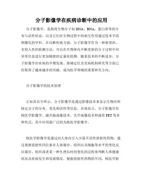 分子影像学在疾病诊断中的应用